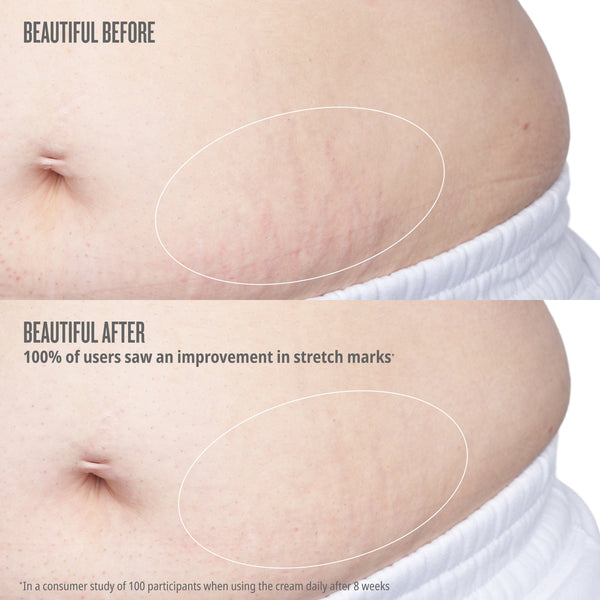 Bum Bum Body Firmeza Oil image 3